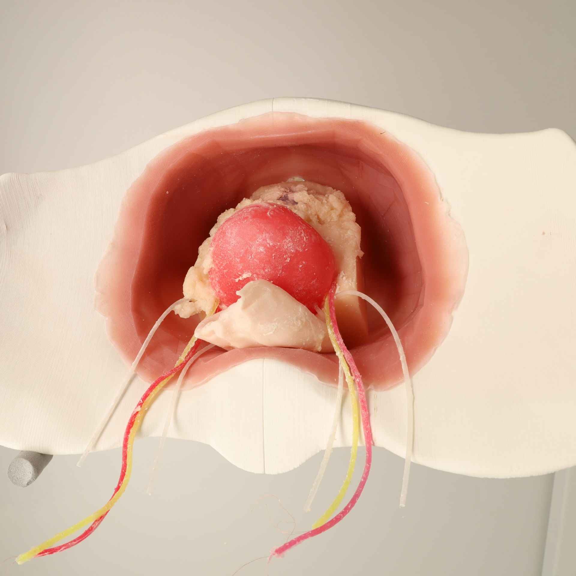 Surgical Training Model For Radical Prostatectomy