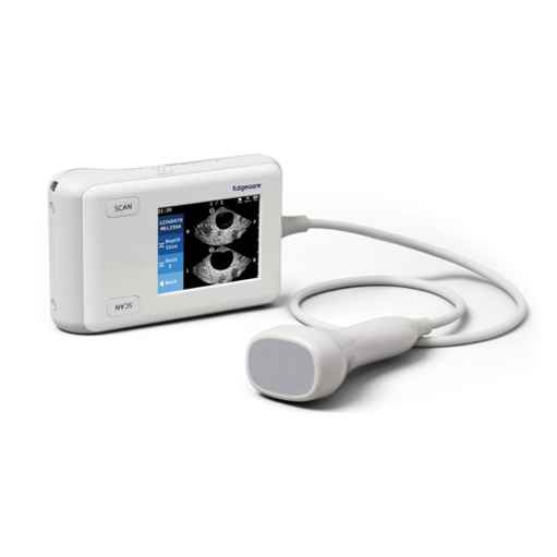 EdgeFlow UH10 bladder scanner