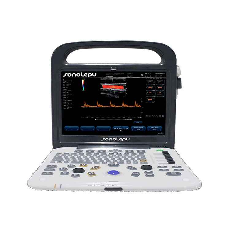 C3 Portable Ultrasound