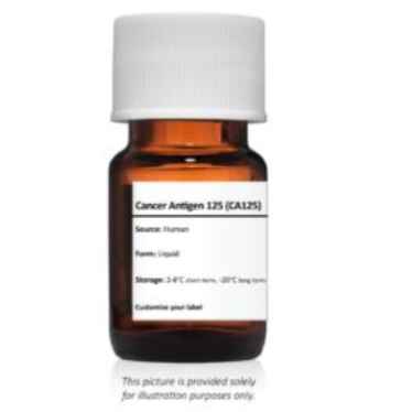 Cancer Antigen 125 (CA125)