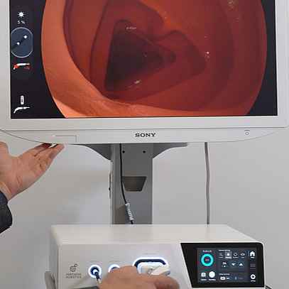 SIRIUS Endoscope System