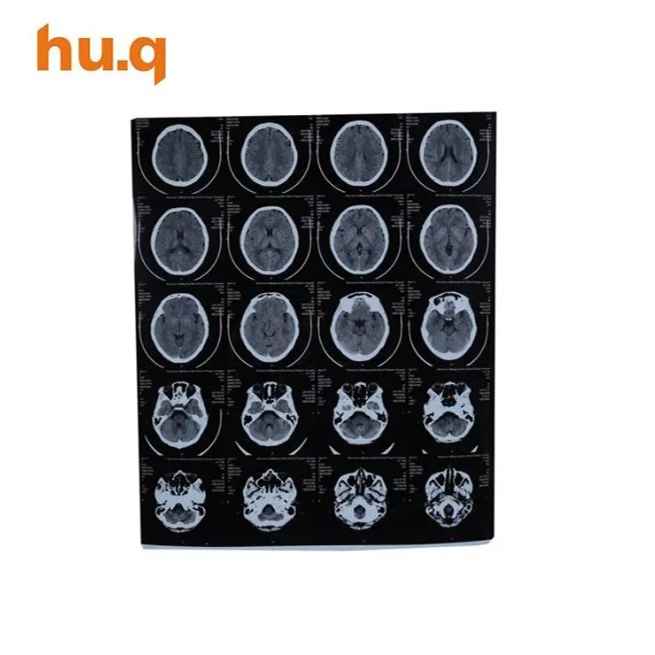 HQ-KX410 Medical Dry Film