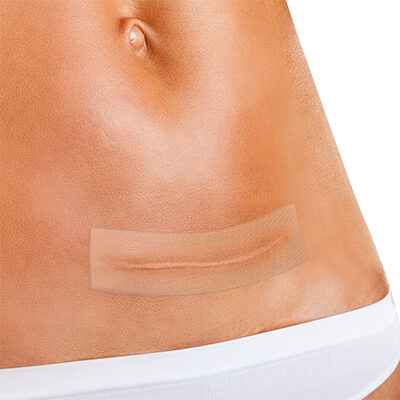 SILICONE SHEET