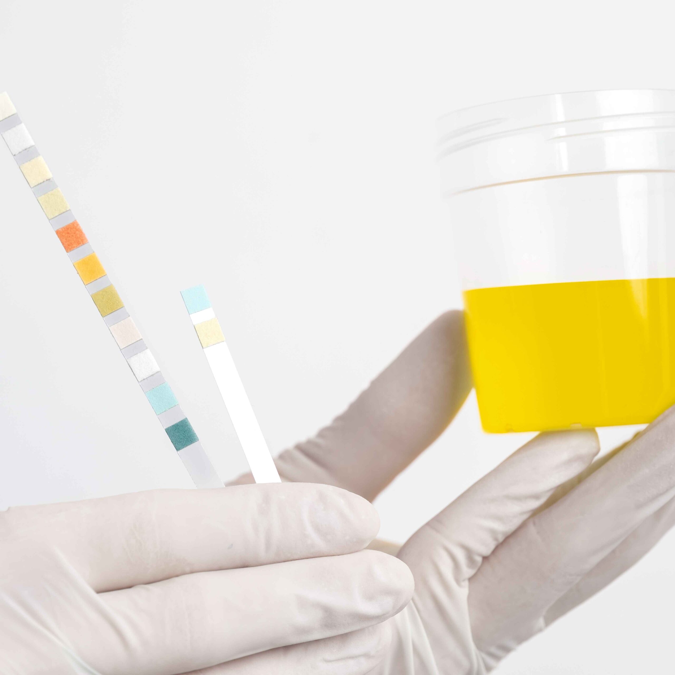 Urinalysis Reagent Dipsticks - 2 parameters