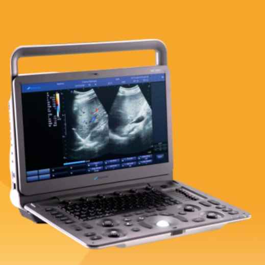 Ultrasound System DUS – 5000 +