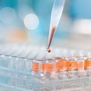 5x Elisa Coating Buffer