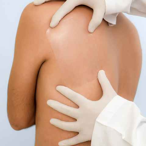 Pharmaplast Protectfilm Transparent Dressing