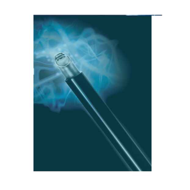 Plasma Disc Decompression