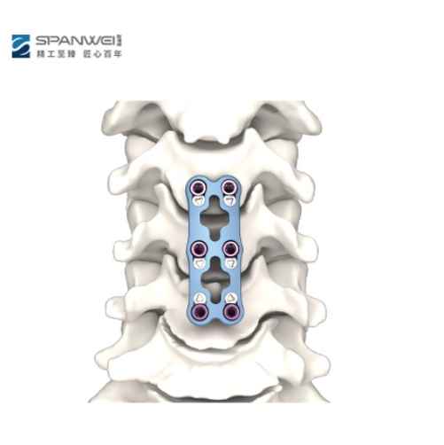 Anterior Cervical Plate