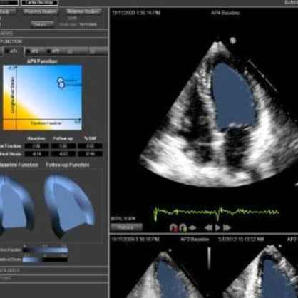 Ligence Heart