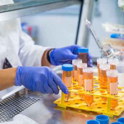 PCR and qPCR setup
