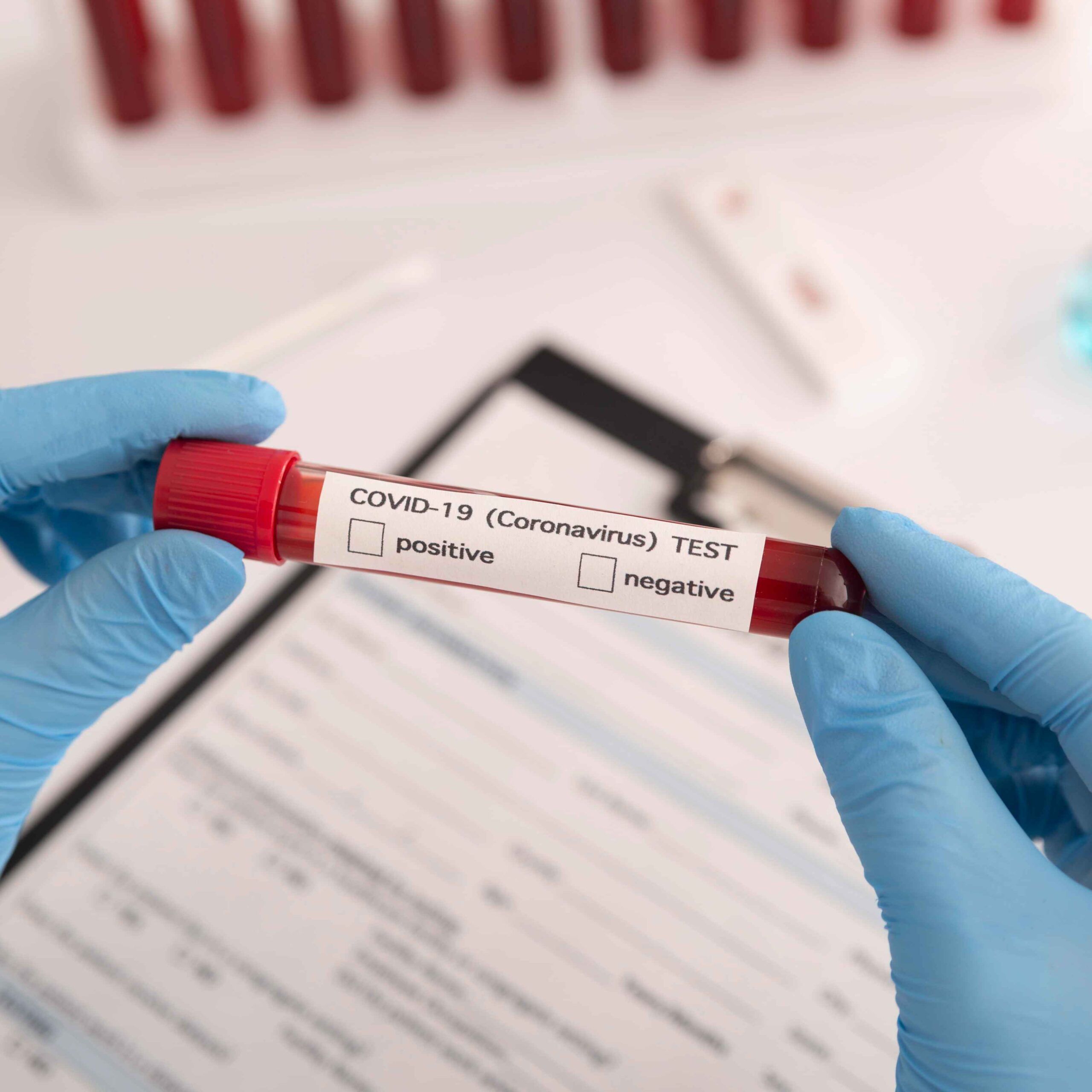 GeWi versus Corona virus