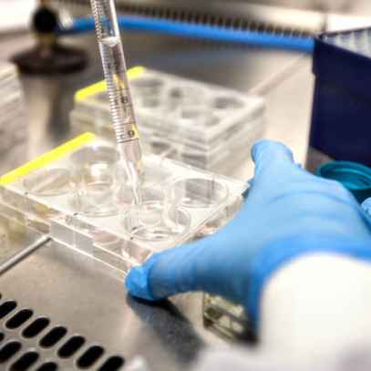 Flexible and innovative products for in vitro diagnostics