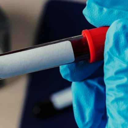 Supply Laboratory Products